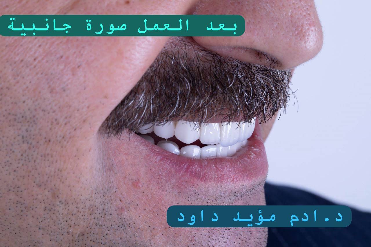 لقطة جانبية للابتسامة تحمل اسم الدكتور آدم مؤيد داود